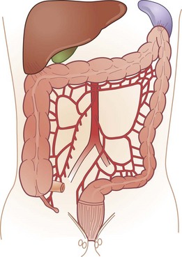 hepatic flexture location