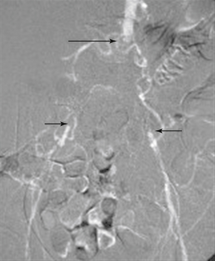 conventional-arteriography-magnetic-resonance-angiography-and