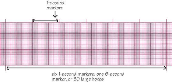 ecg-interpretation-for-nclex-part-two-the-nurse-speak