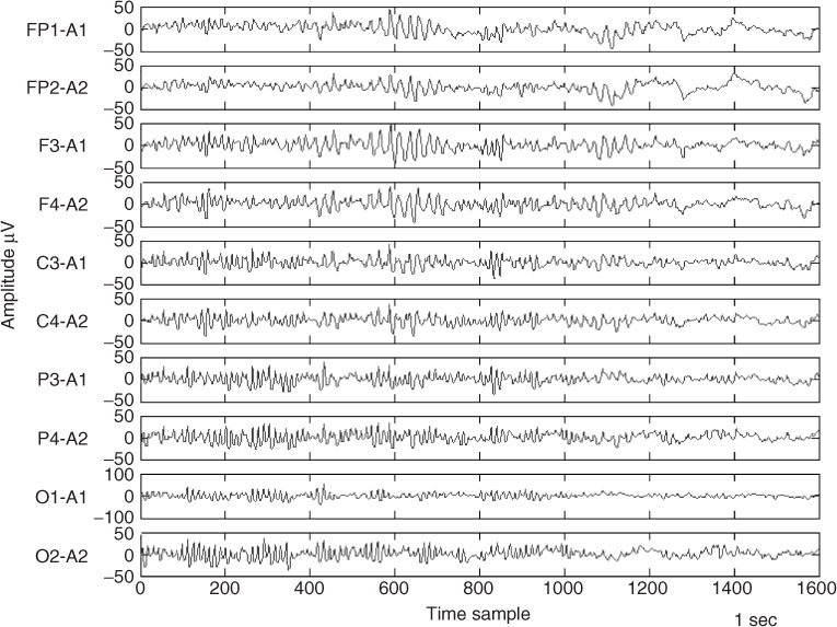 sleep eeg