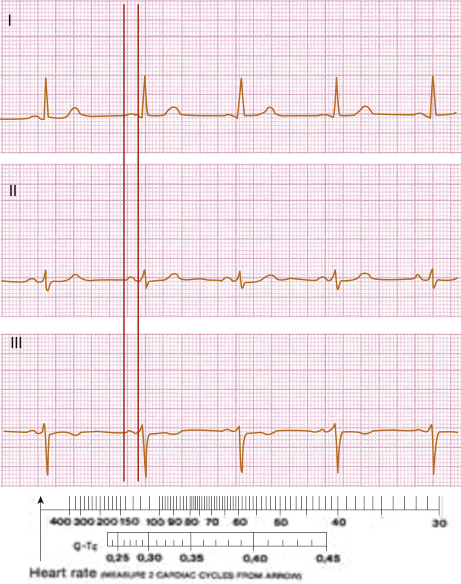 c4-fig-0002