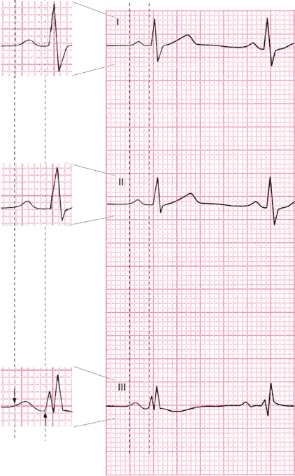 c4-fig-0003