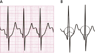 c4-fig-0004