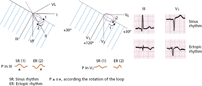 4: ECG Interpretation