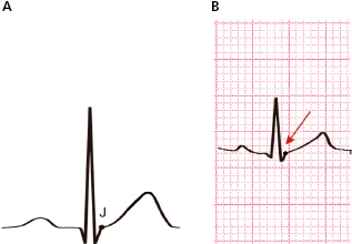 c4-fig-0008