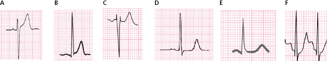 c4-fig-0010