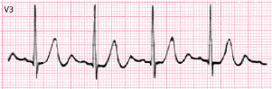 c4-fig-0013