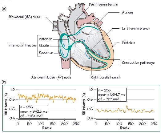 The normal P wave | Thoracic Key