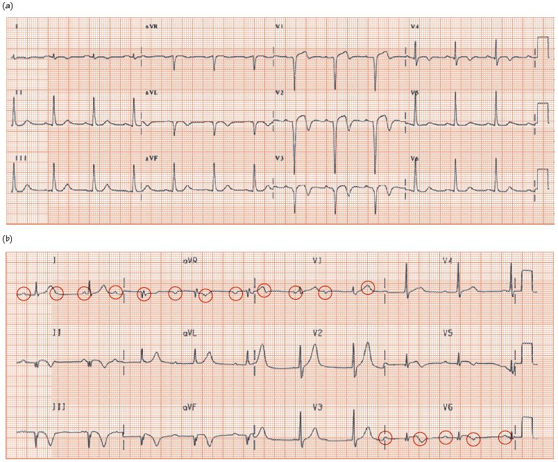 fig9.2.gif