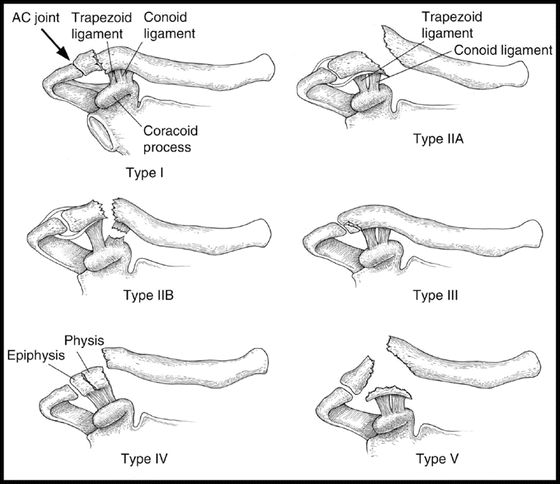 A321656_1_En_15_Fig6_HTML.gif