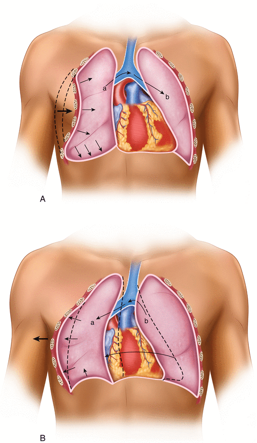 Introduction Epidemiology And Definition Of Chest Wall Injuries 