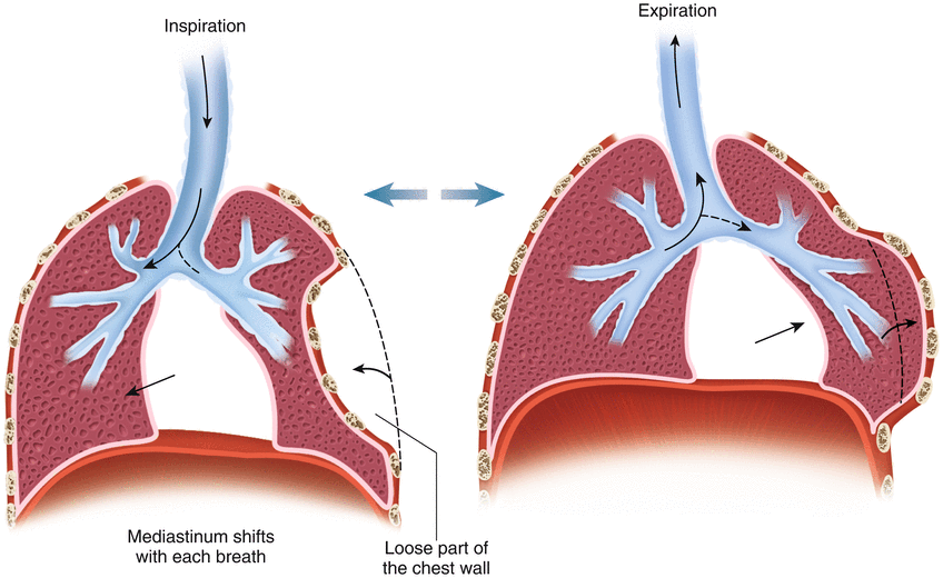 paradoxical breathing