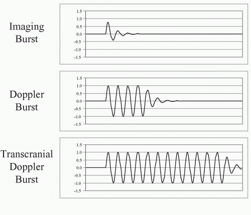 Physics and Instrumentation in Doppler and B-mode Ultrasonography