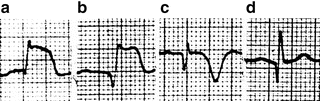 A182916_1_En_11_Fig14_HTML.gif