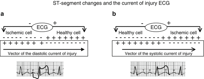 A182916_1_En_11_Fig5_HTML.gif