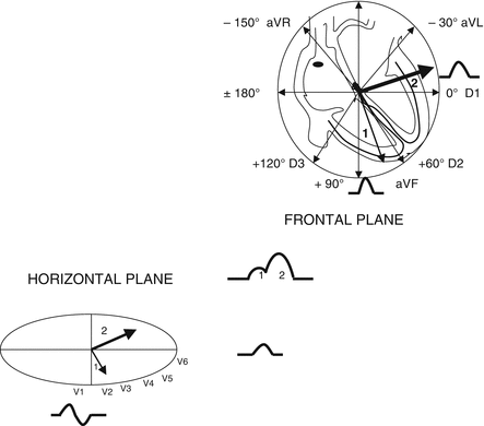 A182916_1_En_12_Fig3_HTML.gif