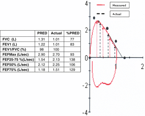 A300366_1_En_7_Fig9_HTML.gif