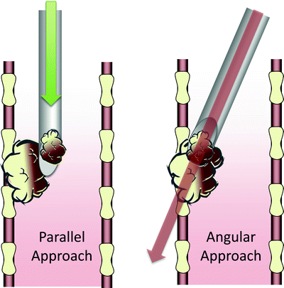 A978-1-4614-4292-9_25_Fig3_HTML.gif