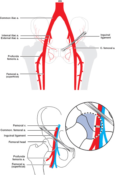 Vascular Access | Thoracic Key