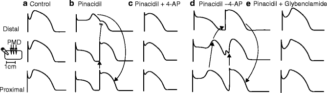 A127647_2_En_16_Fig3_HTML.gif