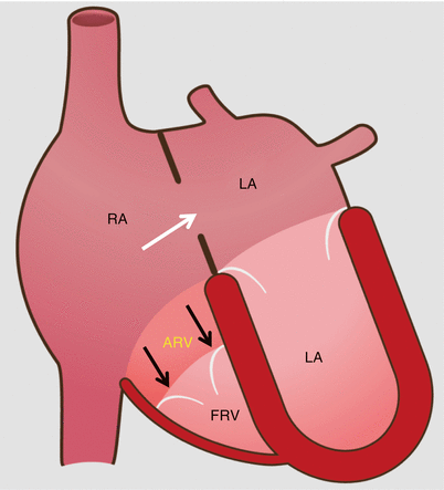 A311877_1_En_12_Fig1_HTML.gif