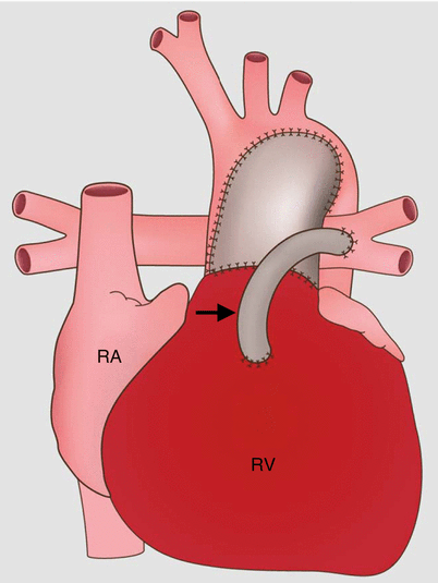 A311877_1_En_31_Fig3_HTML.gif