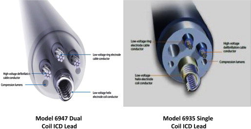 Vs dual coil single Single vs