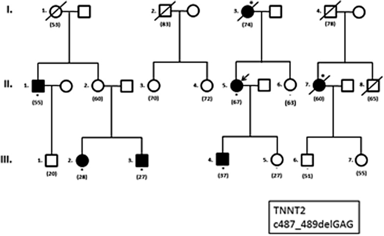 Hypertrophic Cardiomyopathy: One Gene … but Many Phenotypes | Thoracic Key