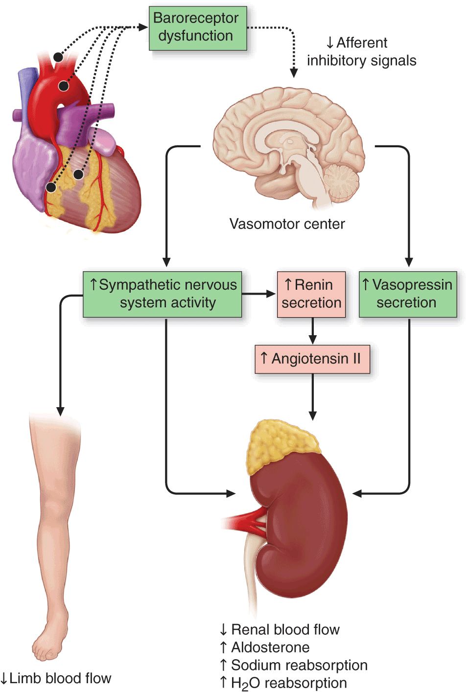 Congestive Heart Failure And Cor Pulmonale Anesthesia Vrogue Co