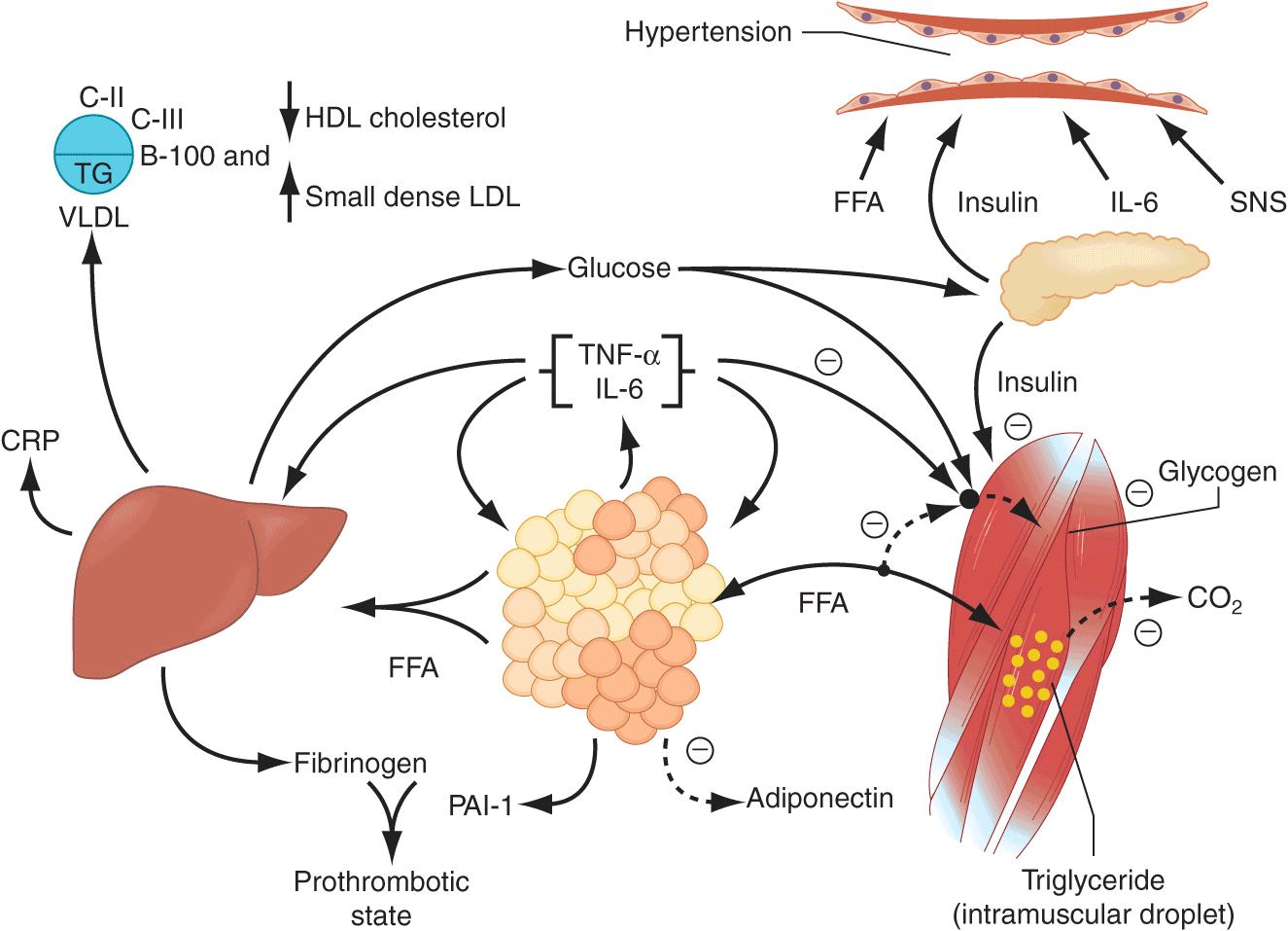 Metabolic syndrome - Cholesterol - Triglycerides - Blood sugar