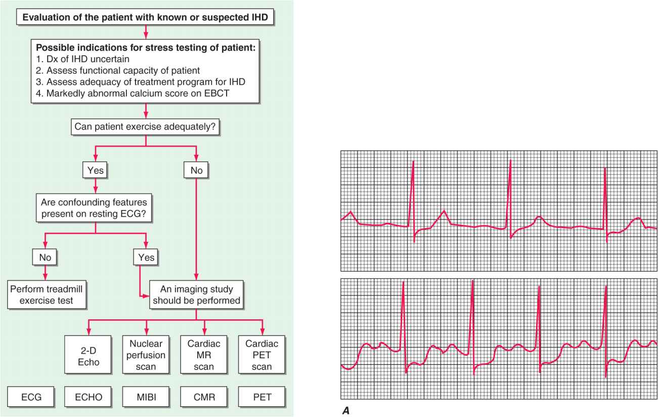 ischemic-heart-disease-thoracic-key