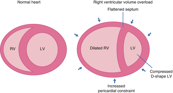 A319969_1_En_8_Fig3_HTML.gif