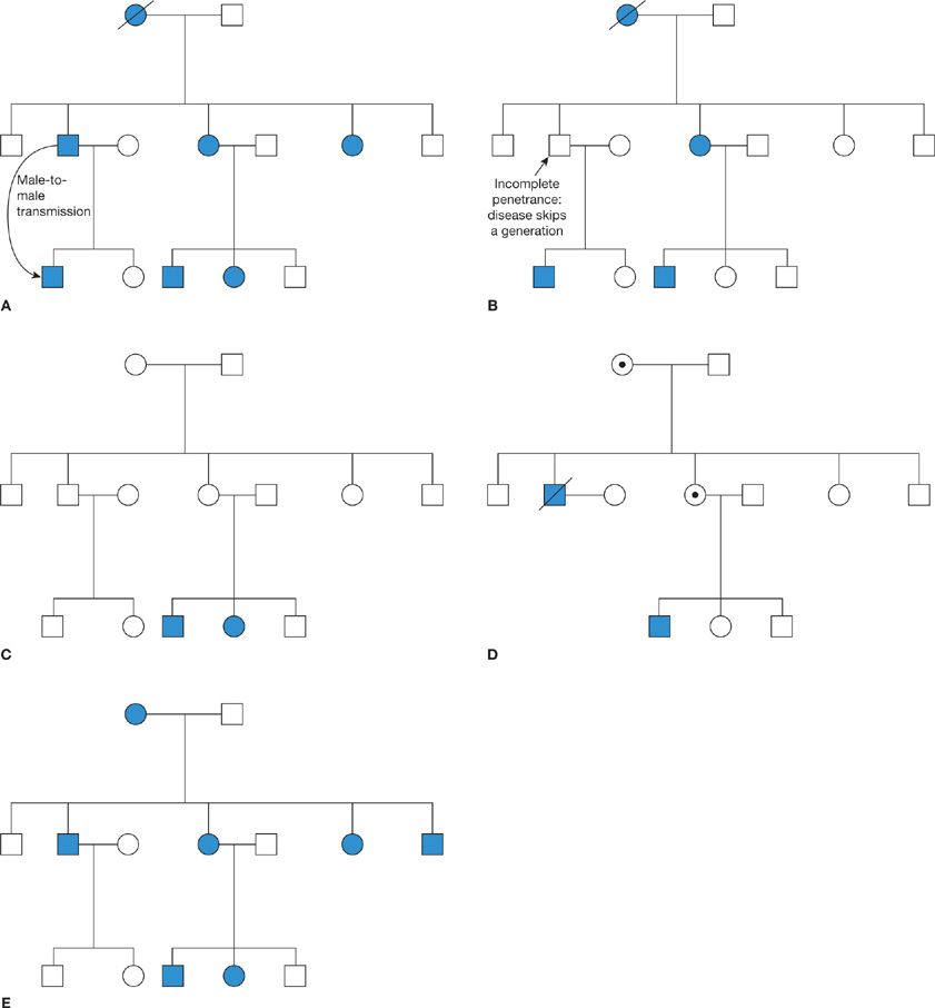 The Genetic Basis of Respiratory Disorders | Thoracic Key