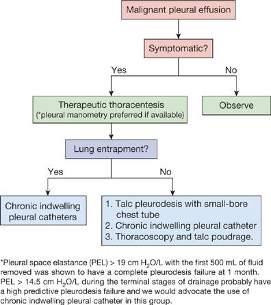 Malignant Pleural Effusions | Thoracic Key