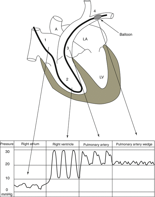 A305677_1_En_4_Fig5_HTML.gif