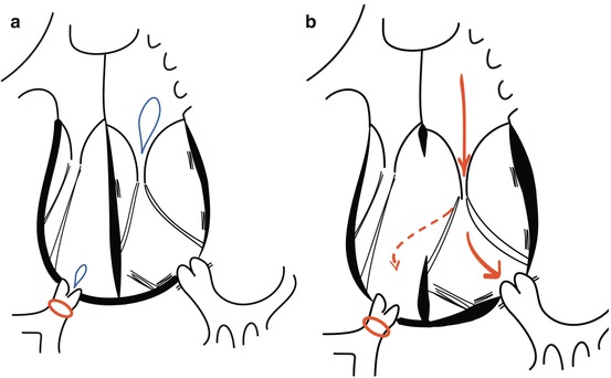 A309853_1_En_9_Fig5_HTML.jpg