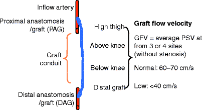 A978-1-4471-4005-4_24_Fig1_HTML.gif