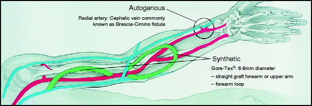 A978-1-4471-4005-4_35_Fig9_HTML.gif