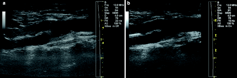 Principles Of Vascular Ultrasound Physics Thoracic Key