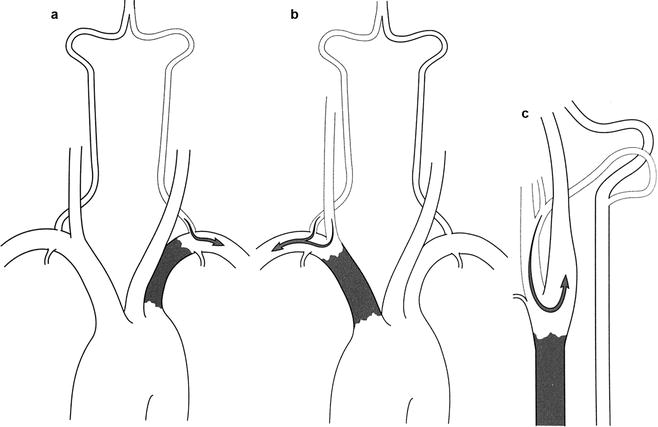 A978-1-4471-4005-4_6_Fig9_HTML.jpg