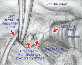 A308478_1_En_10_Fig17_HTML.jpg