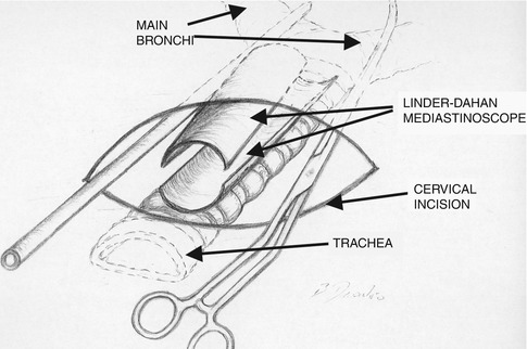 A308478_1_En_10_Fig18_HTML.jpg