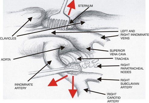 A308478_1_En_10_Fig8_HTML.jpg