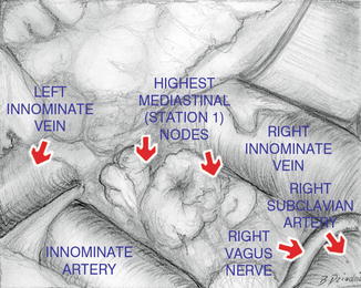 A308478_1_En_10_Fig9_HTML.jpg