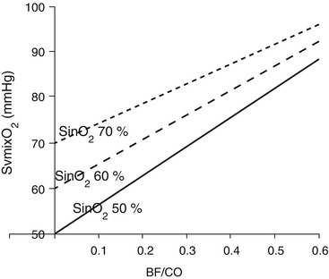 Schematic representation of Riley's threecompartment lung model