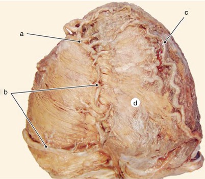 A312702_1_En_8_Fig9_HTML.jpg