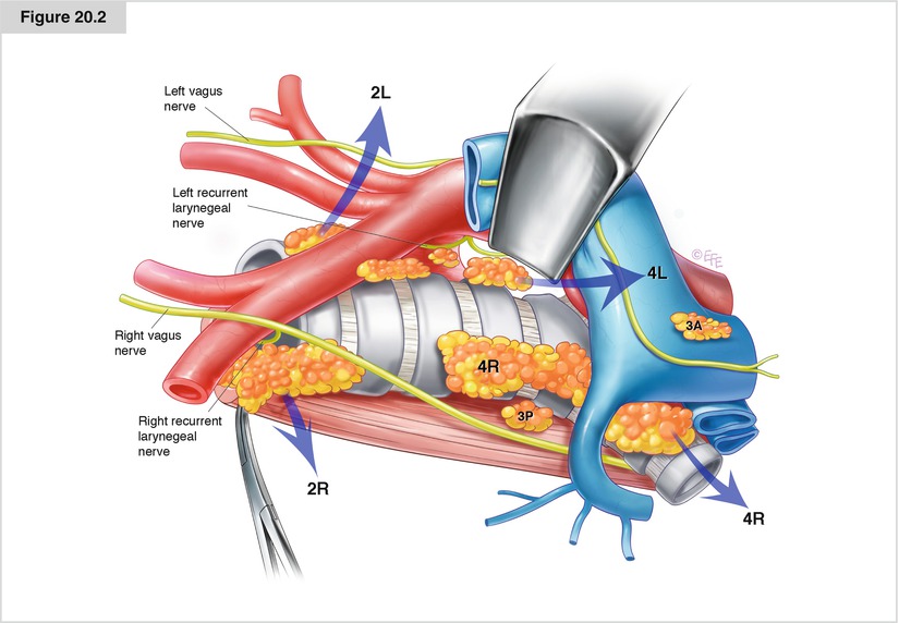 Lung Lymph Node Anatomy