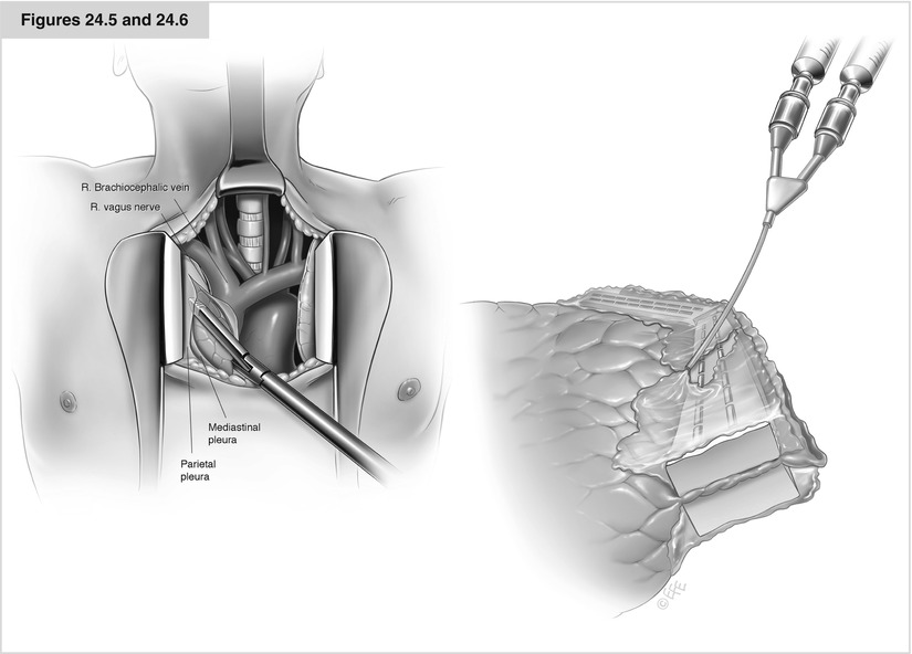 A194303_1_En_24_Fig3_HTML.jpg