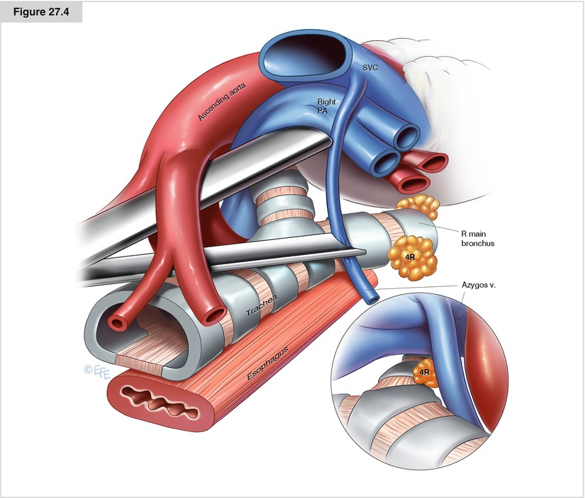 A194303_1_En_27_Fig4_HTML.jpg