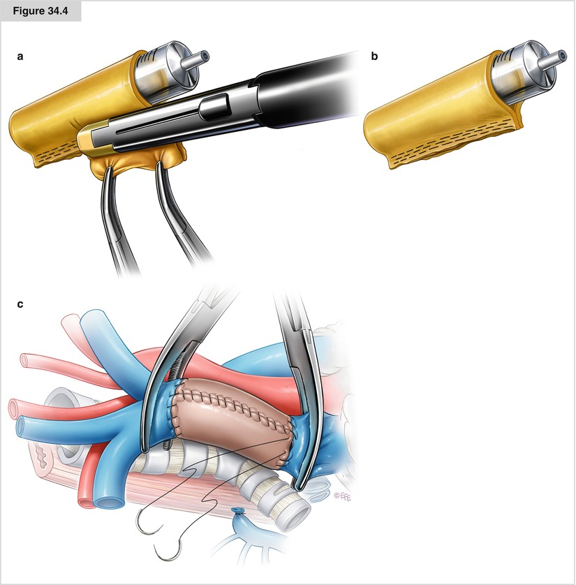 A194303_1_En_34_Fig4_HTML.jpg